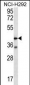 F2RL2 Antibody (N-term)